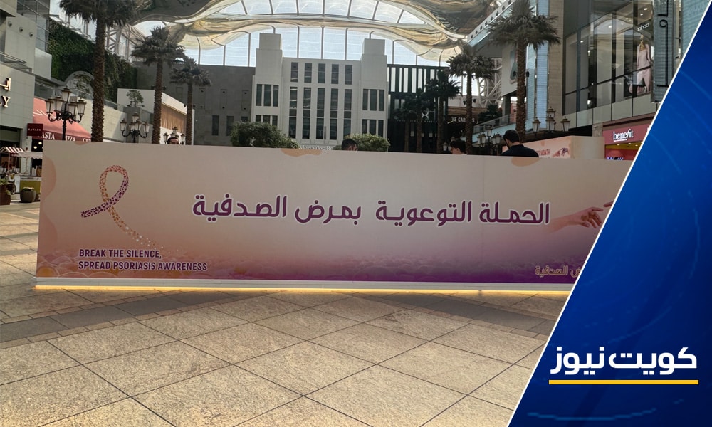 وزارة الصحة تنظم حملة توعية بمرض الصدفية المزمن
