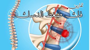 فك ضغط الدسك و علاج الدسك نهائيا | خطوة بخطوة