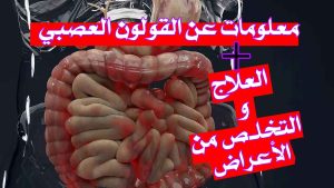 معلومات عن القولون العصبي/ كيف تتفوق الأدوية في تحسين أعراض القولون العصبي؟