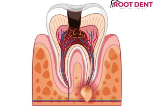 الأوعية الدموية في الاسنان